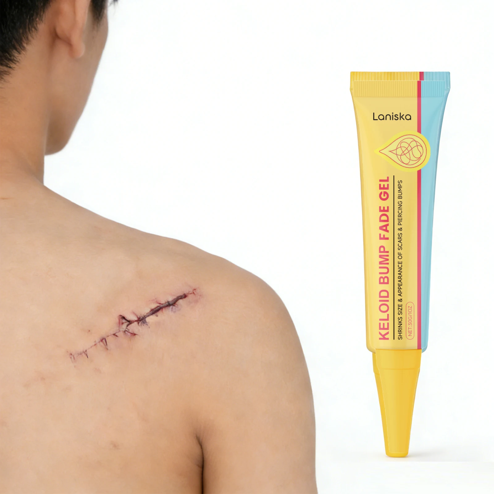 

Keloid Bump Fade Gel Shrinks Scars Bumps Lasting Moisturizing Smoothing Skin Cream Reduce Redness Itching Repair Damaged Skin