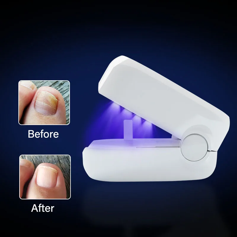 Nail Fungus Laser Led Light Device Fungal Nail Treatment Anti-Equipment Effectively Remove Fungal Toenail Nail Fungal Infection