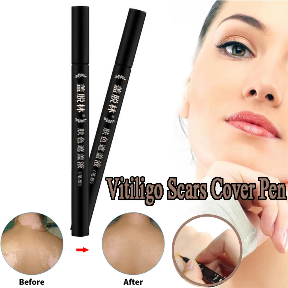 Vitiligo-pluma de cobertura de marcas de nacimiento para mujeres y hombres, corrector profesional de tatuajes con manchas blancas, esencia de plantas a base de hierbas, pluma de cobertura de piel