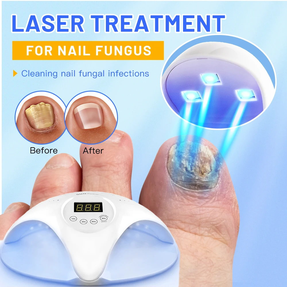 2-In-1 Fungal Nail Laser Device Repair Fast Nails Fungus Onychomycosis Repair Toenail Fingernail Removes Nail Fungus Foot Care