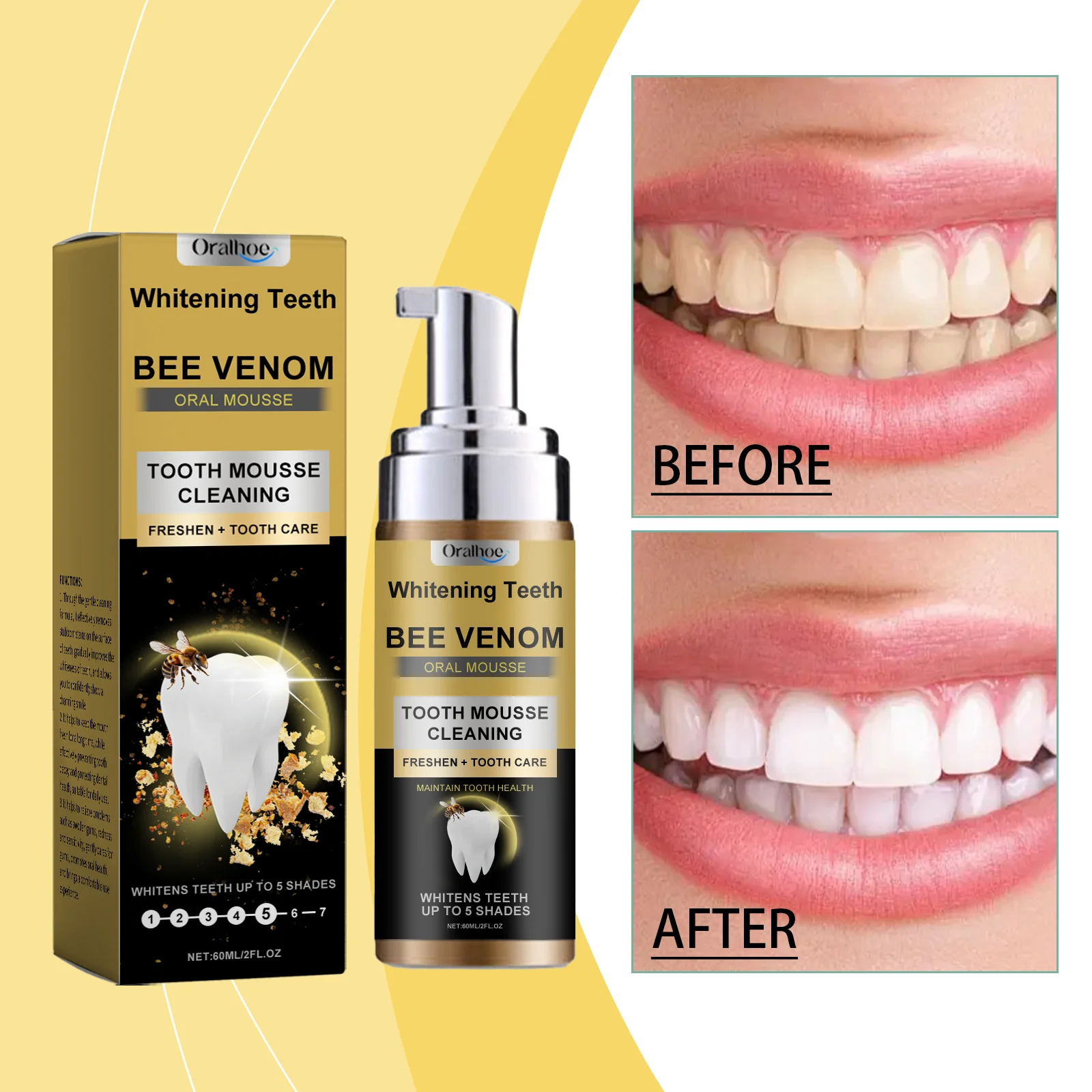 Dental Mousse Removes Tobacco Stains Removes Yellowing Freshens Breath Effectively Brightens and Removes Yellowing Oral Care