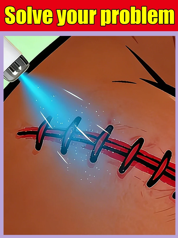 2026new generation laser pens to solve your scar problems and keep your skin healthy  free shipping