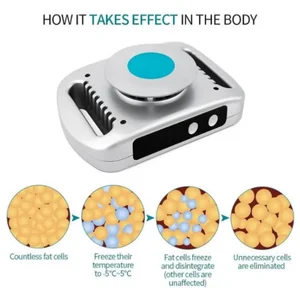 10 Best Sales Cryolipolyse Machine -№6