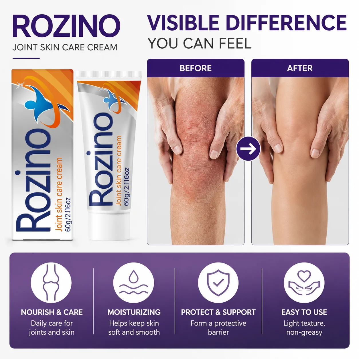 ROZINO joint skin care cream has a fine and smooth texture, feels refreshing and non-sticky on the skin. It can gently care for the skin around various joints such as shoulders, knees, and wrists, soothing dryness and roughness, and alleviating skin tightness and discomfort. Apply an appropriate amount to the joint areas and massage gently to help the nourishing ingredients penetrate, suitable for daily basic care of the skin around joints throughout the body.