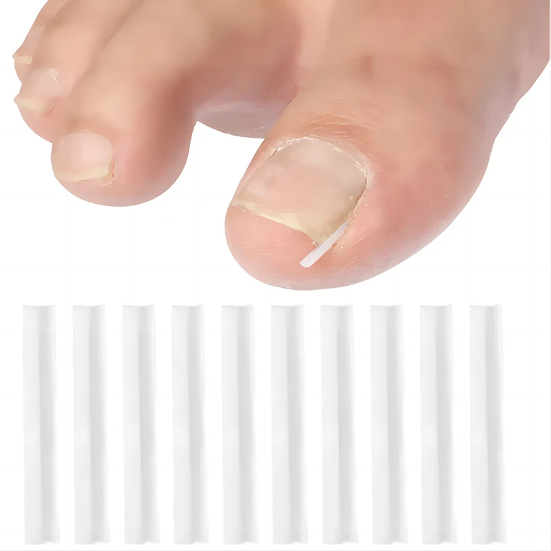 Ingrown Toenail Correction Tool Nail Filling Pad Ingrown Toe Nail Treatment Elastic Patch Straightening Clip Brace Pedicure Tool