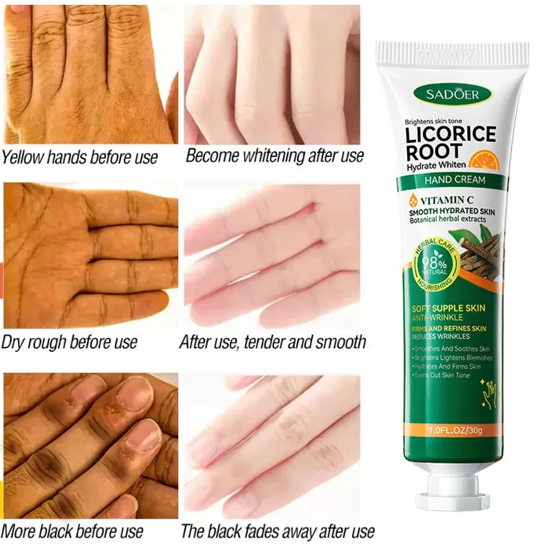 

Быстро отбеливающий крем для рук с темными суставами, Осветляющий крем для рук, корректор меланина, увлажняющий интенсивный товар, товар для ухода за кожей, Новинка