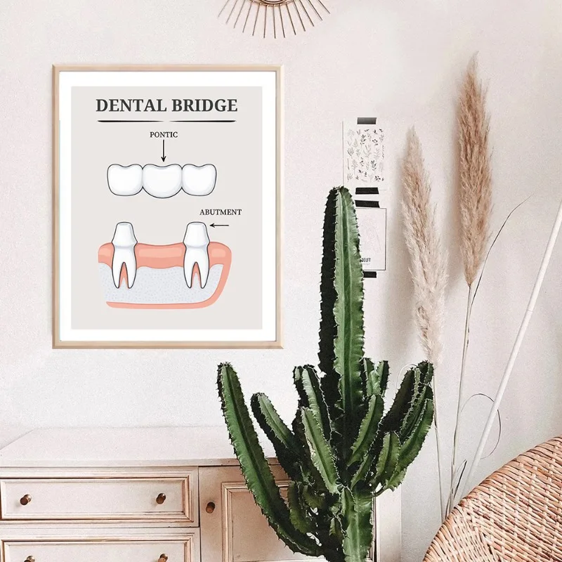 Modern Tooth Anatomy Poster Periodontal Disease Education Dental Hygiene Canvas Painting Wall Art Dental Office Room Decor Decor