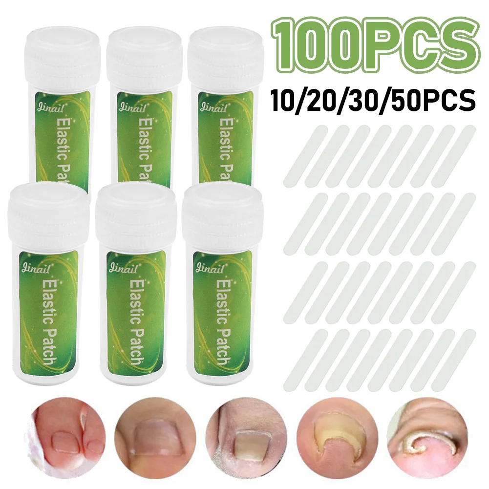 10-100PCS/Bottle Ingrown Toenail Correction Tool Ingrown Toe Nail Treatment Elastic Patch Sticker Straightening Clip Corrector