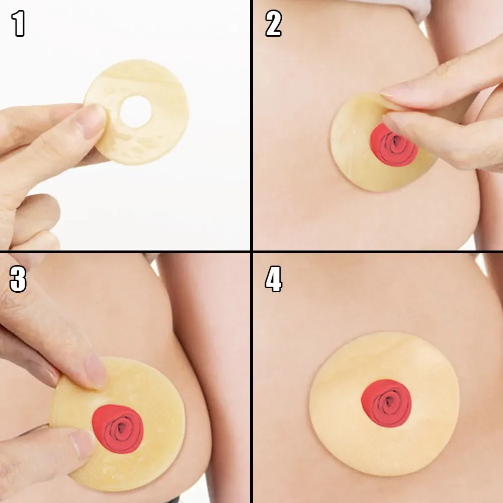 10Pcs Colostomy Care Supplies Portable Leak‑Proof Protective Sticker for Ostomy Bag Anti-Leakage Barrier Ring for Colostomy Bag