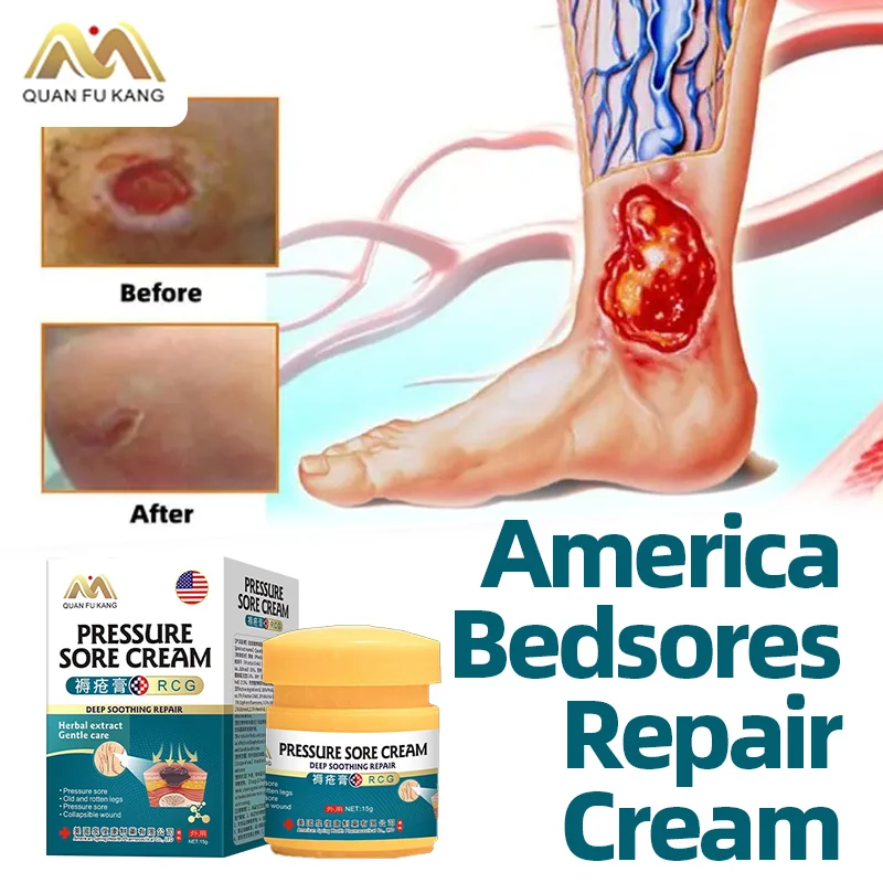 

Bedsores Cream Anti Bed Sore Wound Healing Treatment Skin Pressure Ulcer Decubitus Remove Rot Myogenic American Formula Medicine