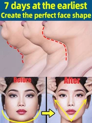 Professional Remove Double Chin Face Slimming V Shape Firming lift