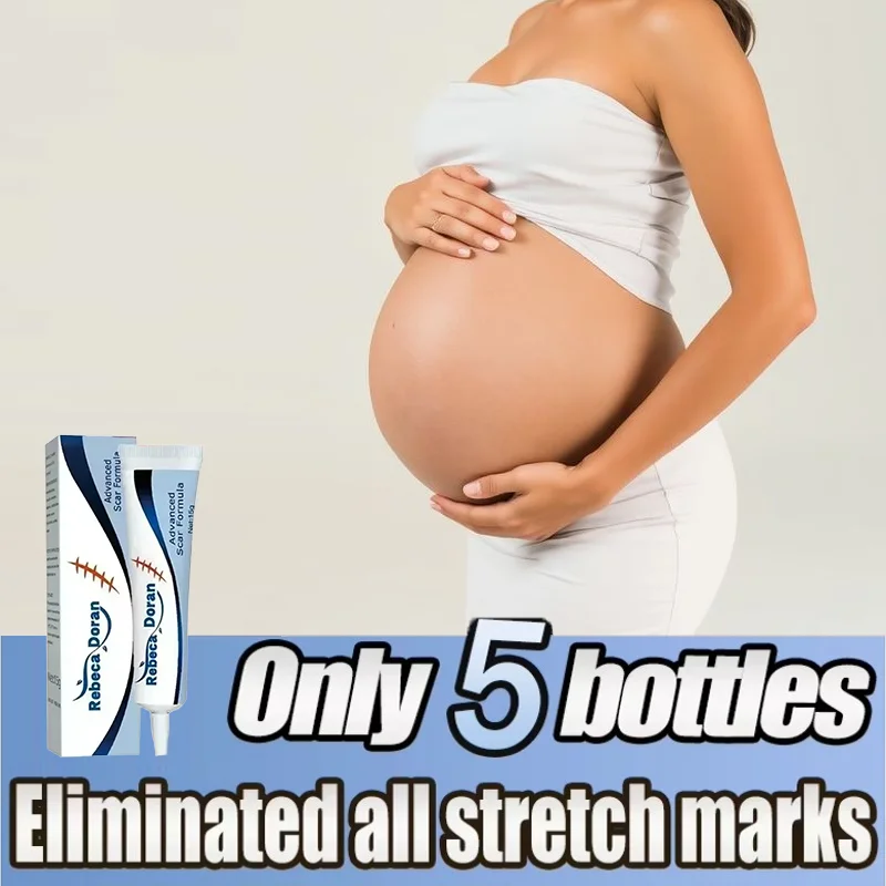 

Removes Stretch Mark Cream To Remove Postpartum Obesity Pregnant Women Repair Anti-Aging Winkles Firming Body Cream Skin Care
