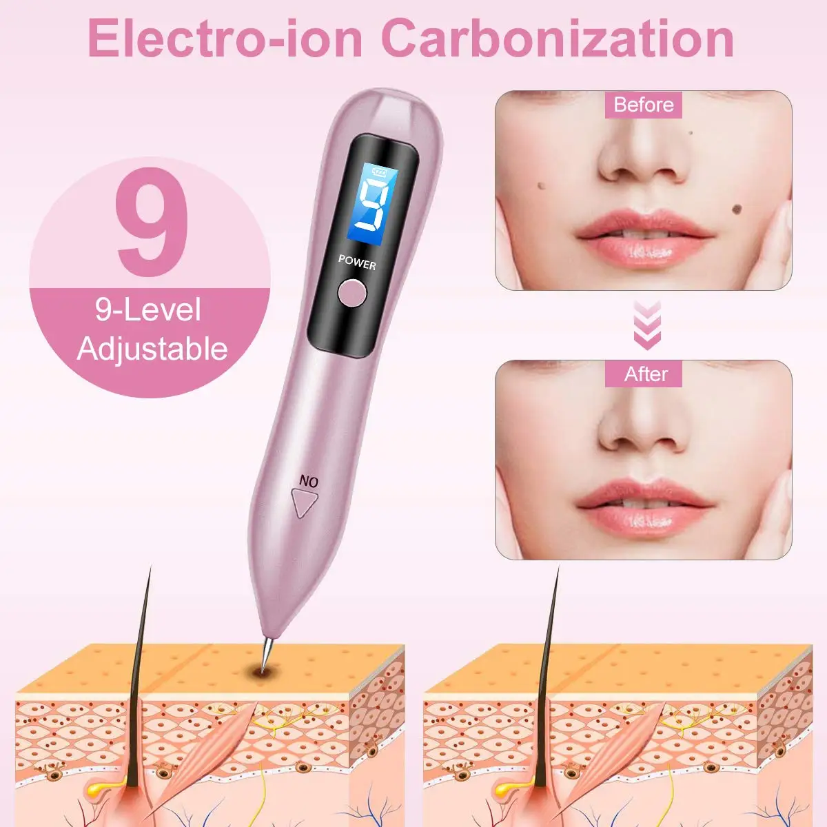 Home Use Laser Machine for Wart Mole Freckle Tattoo Removal with USB Handheld Plasma Lifting Pen Face Neck Arm Lift