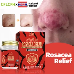 Thailand Rosacea Treatment Cream Anti Nose Mites Blackhead Acne Remover Red Nose Repair Face Shrink Pores Skin Care