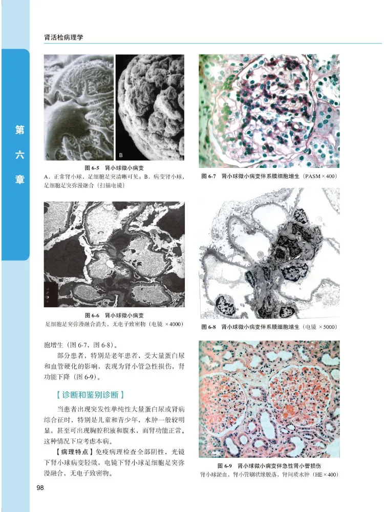 Book-Winshare Kidney Biopsy Pathology 6th Edition