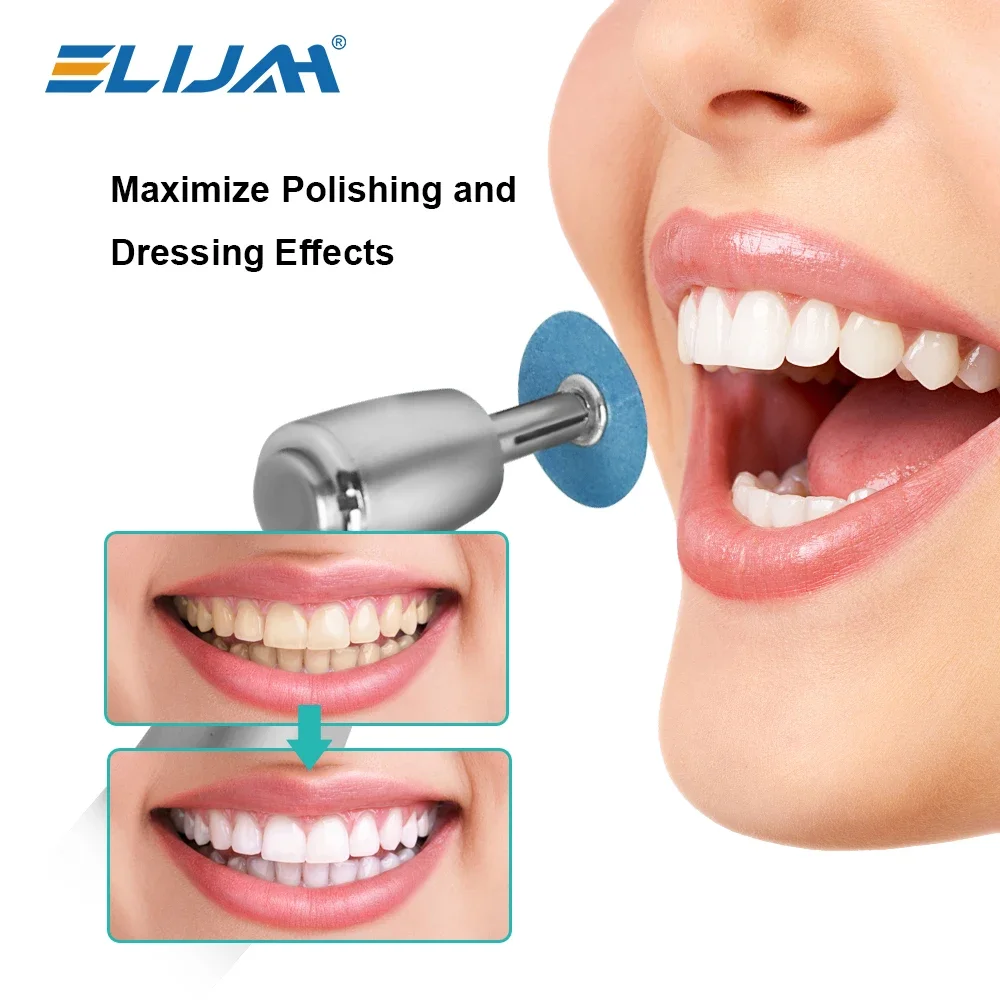 

ELIJAH 5Pcs Dental Polishing Shank Dental Holding Needle Polished Shaft Dental Polishing Shank Mandrel Burs Rotary Lab Tools