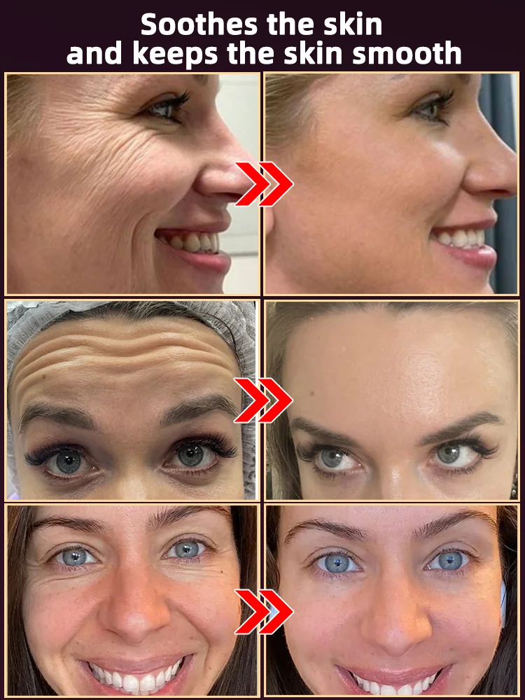 Máscara de olho para dormir instrumento de massagem de olhos de gel frio de colágeno