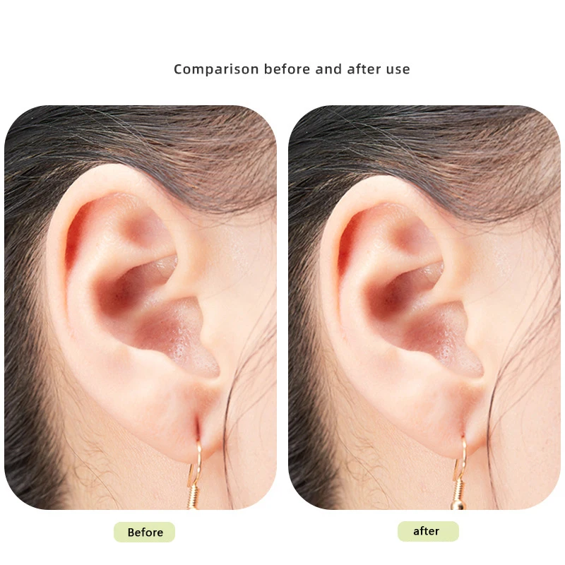 Clear Earring Support Patches, Brinco Backs para Orelhas Droopy, Evitar Puxar, Produtos de Cuidado Orelha, 50 Adesivos