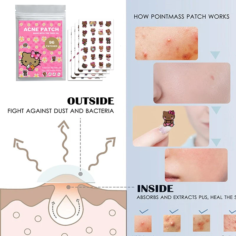 แผ่นแปะสิวรูปซานริโอ้ เฮลโลคิตตี้ 96 ชิ้น ลายการ์ตูนคุโรมิ แผ่นปิดสิวแบบใส ปกปิดสิว กำจัดสิว แผ่นแปะดูแลผิว