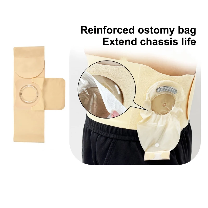 통기성 있는 장루개복대 의료용 허리 지지대 복부 스토마 휴대용 복부 탈장 예방