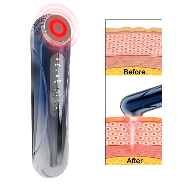 

Высокочастотный аппарат для ухода за лицом и другое бытовое косметологическое оборудование