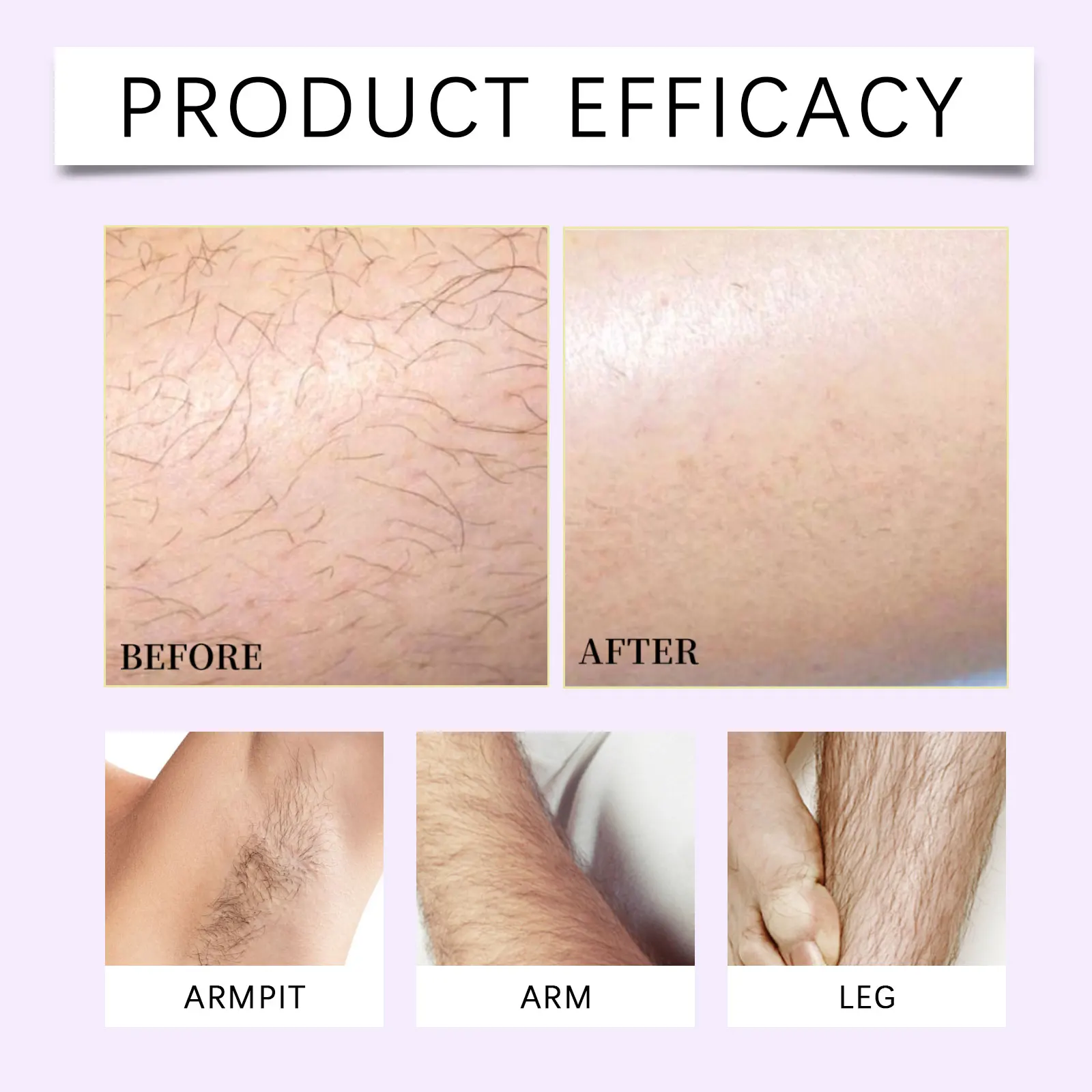 Sanfte Haarentfernungs-Mousse-Spray-Schaber Schnell Beruhigende Körper-Enthaarungscreme für Frauen mit Empfindlicher Haut für Achseln und Beine 100ml – Detail 7