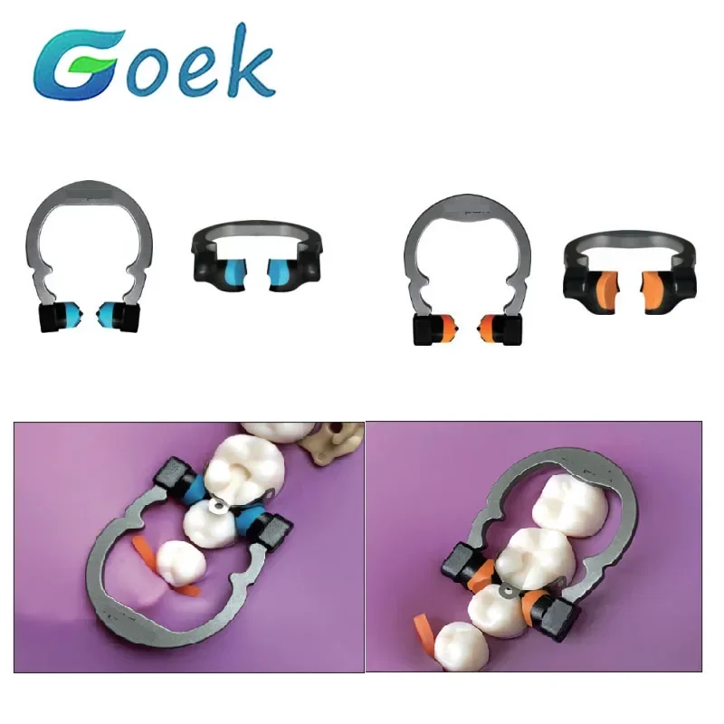 

Стоматологическое пружинное зажимное кольцо Niti R5 1,0, титан, маленький/синий, средний/оранжевый, хорошая устойчивость, насадки из PEEK, ортодонтические материалы