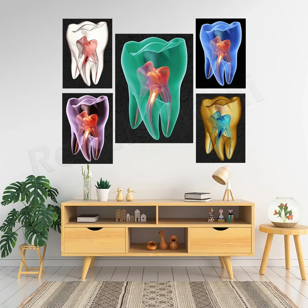 Teeth X-ray, Dental Art, Dentist Art, Dental Clinic Decoration Canvas Wall Art Poster Gift, Anatomy Oral Art Print