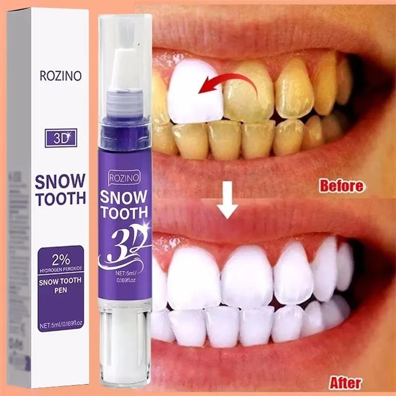 

Teeth Whitening Pen Effective Remove Plaque Stains Oral Hygiene Cleaning Dental Bleaching Tools Fresh Breath Tooth Care Products