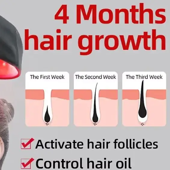 Medical Grade 650nm LLLT Laser Cap Hair Regrowth Helmet Therapy Device for Follicle Activation Thicker Hair Home Treatment