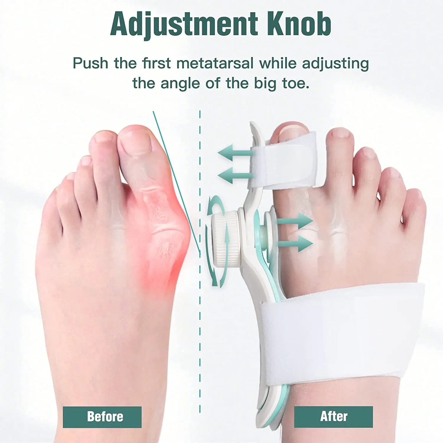 Foot Care Bunion Corrector Orthopedic Bunion Splint for Hallux Valgus Knob Three-angle Fixation Correction Straightener