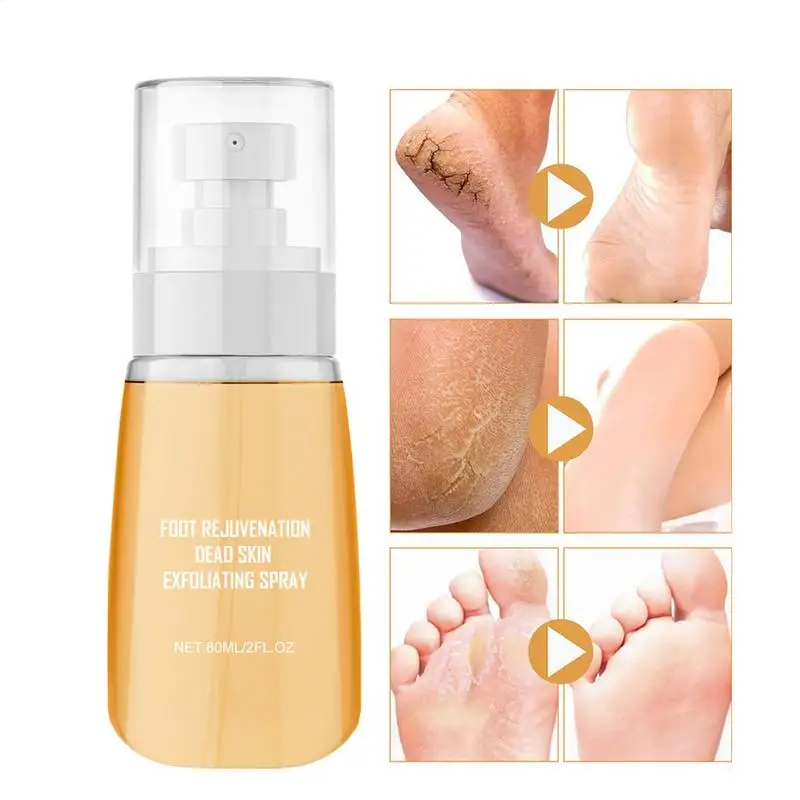 Foot peeling spray 60ml Hydrating Foot Care Spray Pedicure Dead Skin Exfoliator Cleansing Spray for All Skin Types