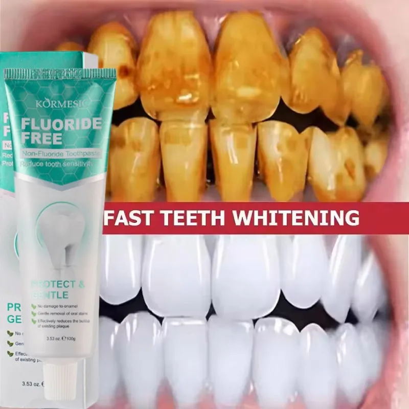 

100g Non-Fluoride Toothpaste Teeth Whitening Removing Yellow Teeth Cleaning Tooth Stain Oral Fresh Tooth Care Product 2025 New