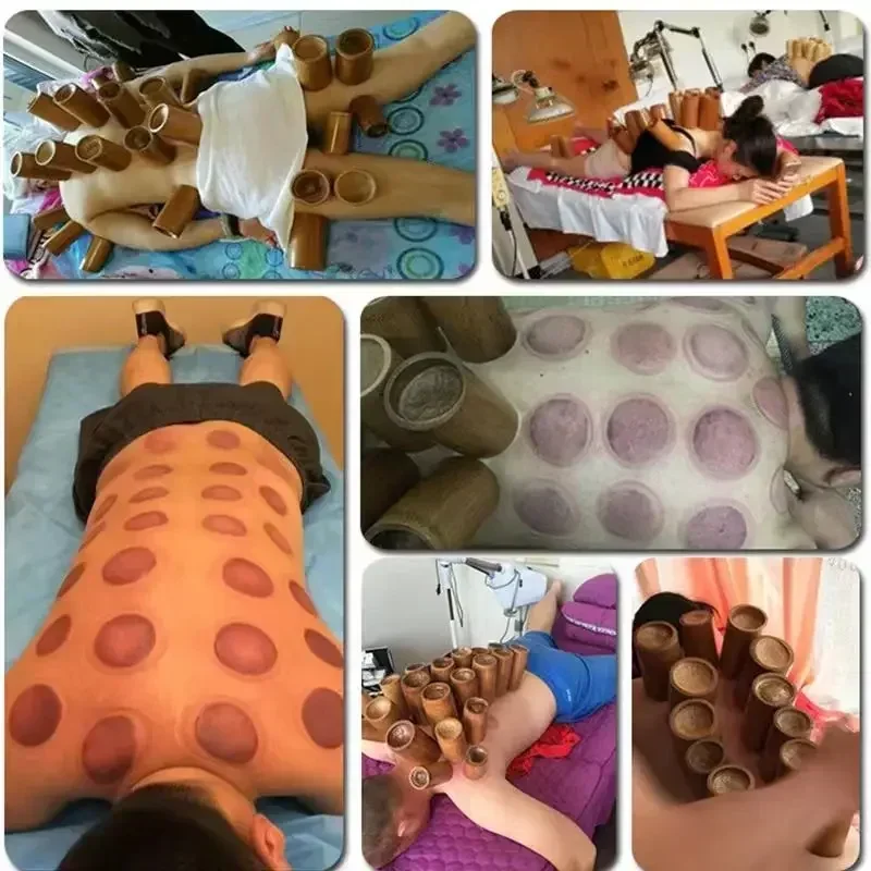 Chinese Traditions Bamboo Cupping Sets Traditional Chinese Medicine Cupping Jar Body Massage Health Care Physiotherapy Tank