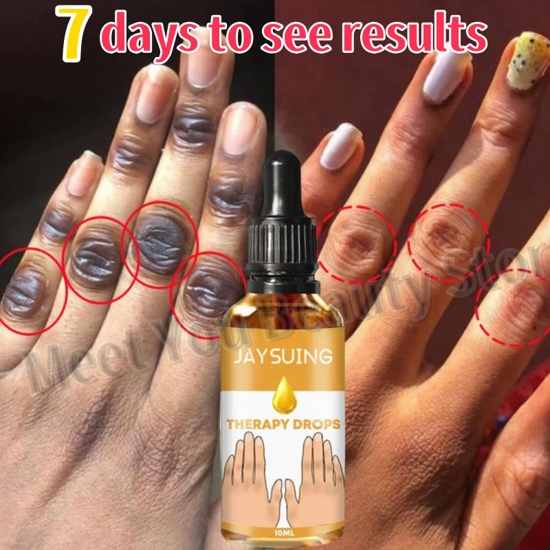 Dark Knuckles Fast Brighten Serum Clarify Black Skin Dark Spot Brightening Serum Elbows Hand Knuckle Knee Lighten Melanin Remove