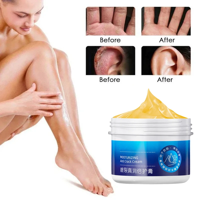 Anti-Drying Crack Hand Foot Care Cream Heel Cracked Repair Products Removal Dead Skin Moisturizing Whitening Nourish Skin Care