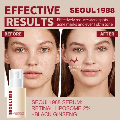 Imagen 2 del producto 1/2/3 Uds. Suero facial de Retinol coreano SEOUL 1988, decoloración de arrugas finas, blanqueamiento hidratante, elimina el punto, reduce los poros, belleza, cuidado de la piel