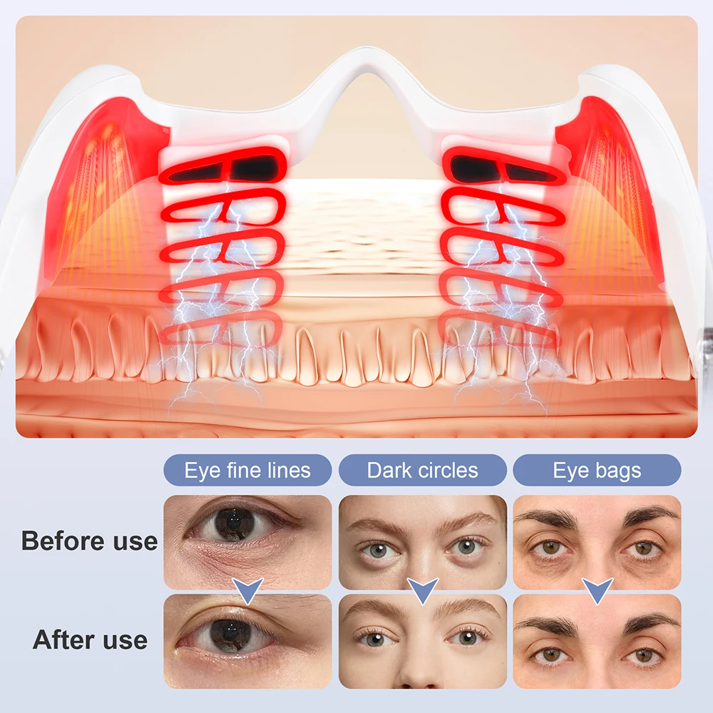 Thumbnail 4 - #43 Cheap Eye Massagers Worth Buying