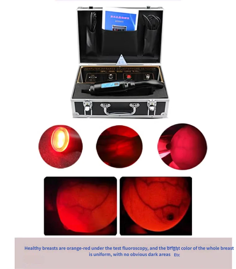 High Definition Far-Infrared Breast Detection Device Multifunctional Convenient Translucent Breast Scanner for Health Check