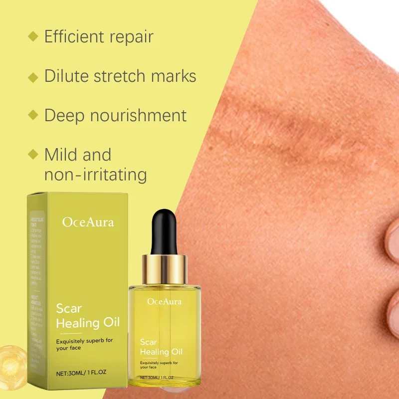 Scar Healing Oil Skin Repair Smooth Gentle Moisturizing Improve Skin Texture Repair Remove Pregnancy Scars Treatment Skin Care