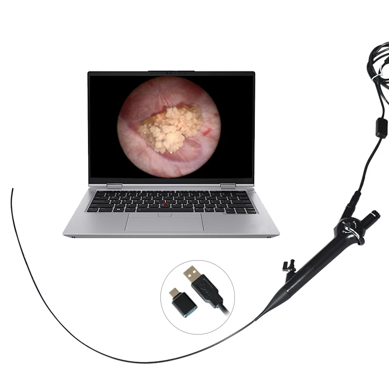 Fuente de luz endoscopio Flexible veterinario ureteroscopio de fibra vídeo endoscopio torre Camara endoscopio fibroscopio
