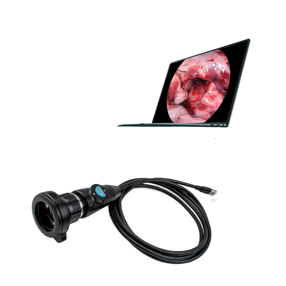 Portable Endoscope Camera For Animals Humans Ent Surgeries With Monitor