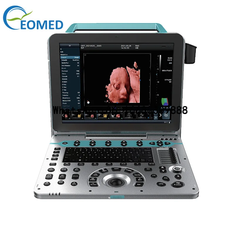 

EO-P50 3D/4D/5D Color Ultrasonic Diagnostic Appartatus Portable Medical ultrasound Machine With 15 Inch LCD HD Display