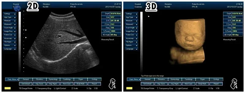 800D 902B cheapest digital portable ecografo ultrasonido portatil Discount price laptop 3D OB GYN ultrasound machine