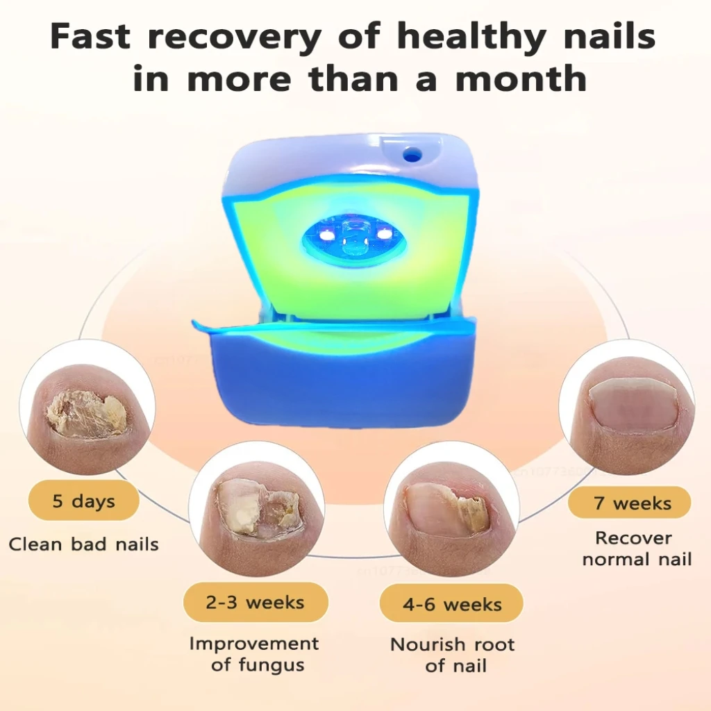 

HLKGO Nail Fungus Laser Device Foot Care Devices Fungal Nail Laser Device Onychomycosis Care 470nm 905nm Infrared