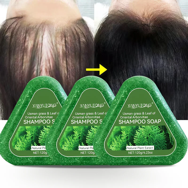 #14 Best Bar Soaps to Buy In 2026