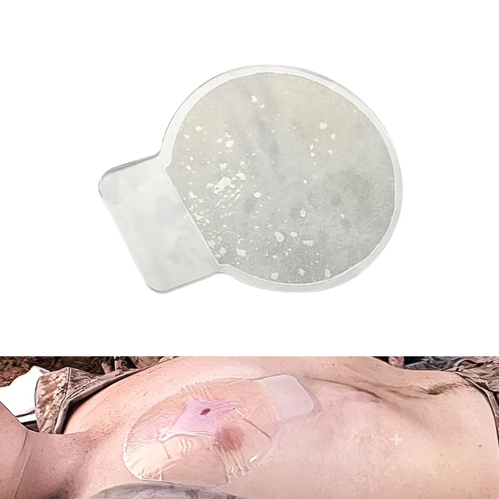 Vent Chest Seal for Open Chest Wounds Vented Outdoor Emergency Rescue Medical Treatment Occlusive Adhesive Dressing Survival Kit