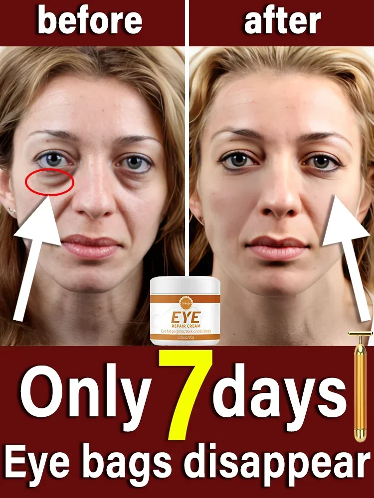 

Electric facial massager vibration beauty pen dark circles eye bags anti-wrinkles face neck beauty device