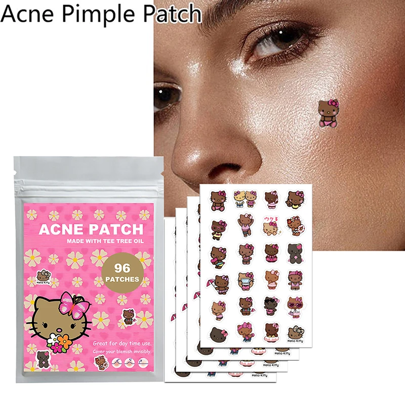 แผ่นแปะสิวรูปซานริโอ้ เฮลโลคิตตี้ 96 ชิ้น ลายการ์ตูนคุโรมิ แผ่นปิดสิวแบบใส ปกปิดสิว กำจัดสิว แผ่นแปะดูแลผิว