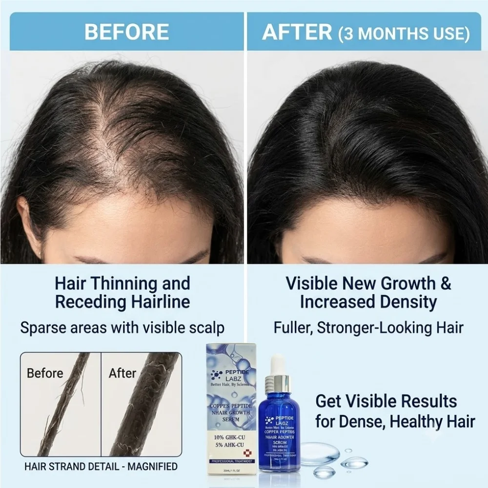 Thumbnail 3 - #9 Latest Hair Loss Treatments Updates